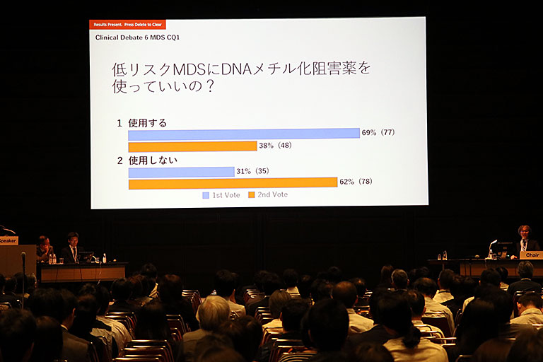 スマホを使って聴衆が投票　ディベート前後で結果が逆転したClinical Questionも